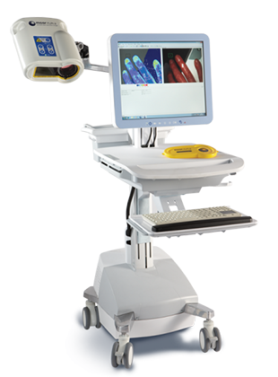 激光散斑血流成像